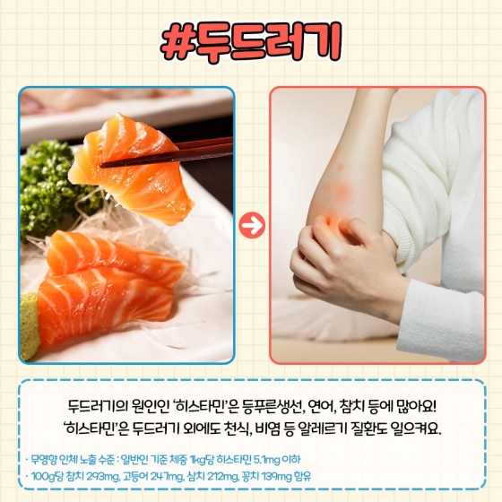 두드러기 : 두드러기의 원인인 ‘히스타민’은 등 푸른 생선, 연어, 참치 등에 많아요! ‘히스타민’은 두드러기 외에도 천식, 비염 등 알레르기 질환도 일으켜요.