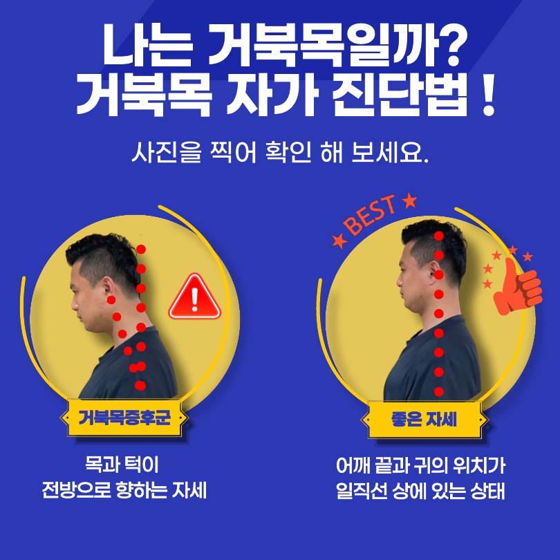 그렇다면 내가 거북목증후군을 앓고 있는지 알아볼 수 있는 방법은 무엇일까요? 간편하게 사진을 찍어 확인할 수 있습니다. 옆에서 사진을 찍었을 때 어깨 끝과 귀의 위치가 일직선 상에 놓였다면 정상이지만 목고 턱이 앞으로 쏠려있다면 거북목 증후군을 의심해 볼 수 있습니다.